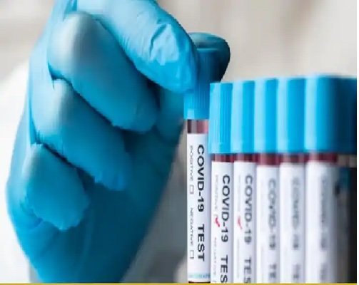 Corona Update: छत्तीसगढ़ में 12 नए कोरोना पॉजिटिव मरीजों की पुष्टि, राज्य में कुल 42 एक्टिव केस